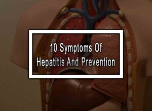 10 Symptoms Of Hepatitis And Prevention