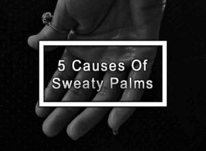 5 Causes Of Sweaty Palms