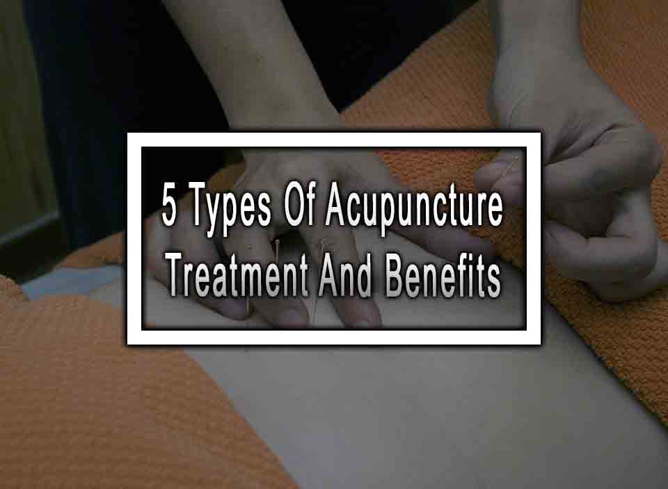 5 Types Of Acupuncture Treatment And Benefits