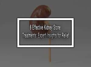 6 Effective Kidney Stone Treatments: Expert Insights for Relief