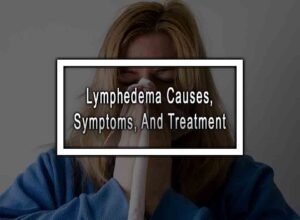 Lymphedema Causes, Symptoms, And Treatment