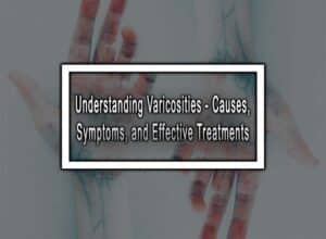 Understanding Varicosities