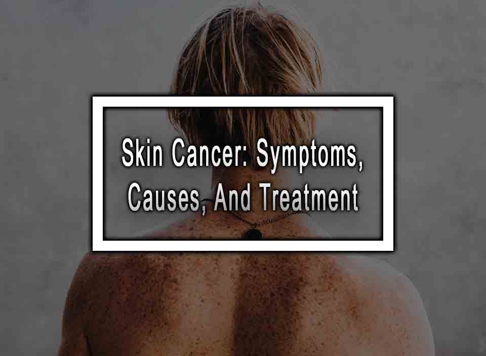 Skin Cancer: Symptoms, Causes, And Treatment