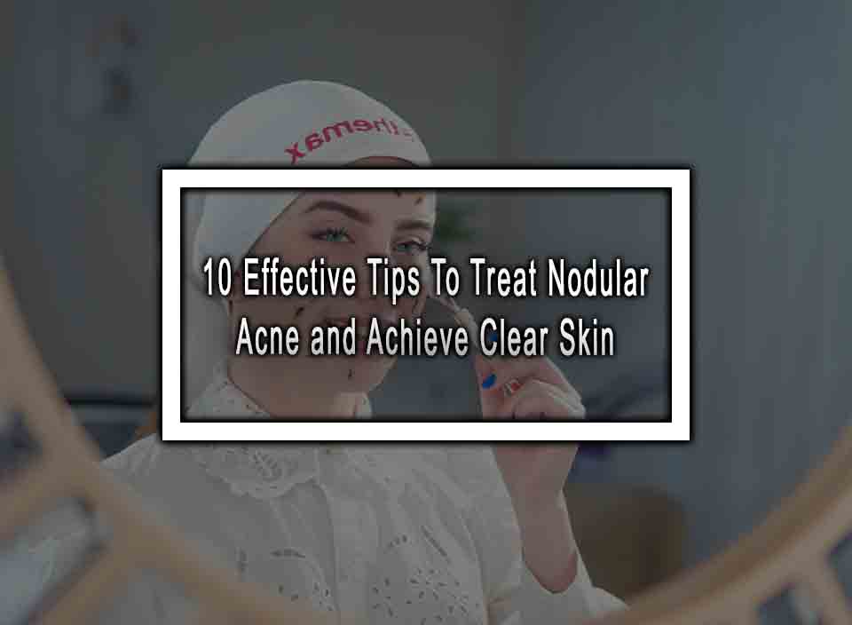 10 Effective Tips To Treat Nodular Acne and Achieve Clear Skin