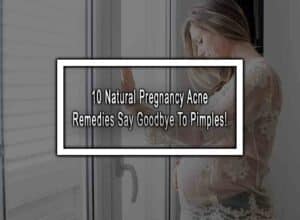 10 Natural Pregnancy Acne Remedies - Say Goodbye To Pimples!