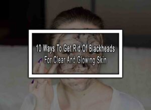 10 Ways To Get Rid Of Blackheads For Clear And Glowing Skin