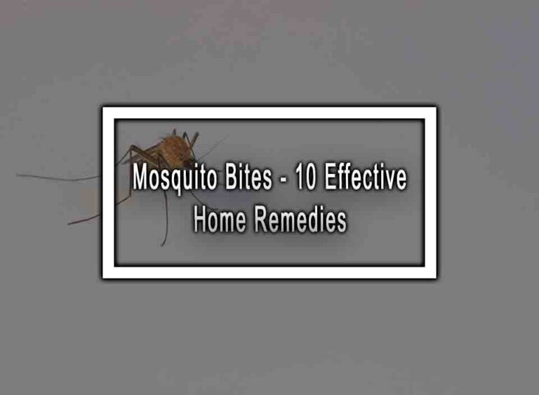 Mosquito Bites 10 Effective Home Remedies