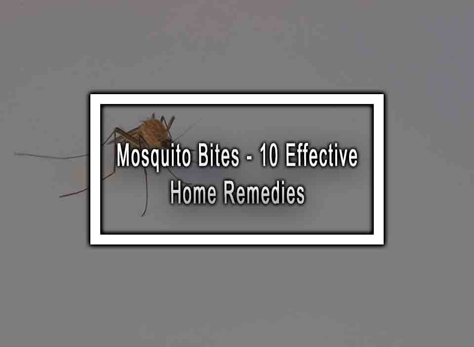 Mosquito Bites - 10 Effective Home Remedies