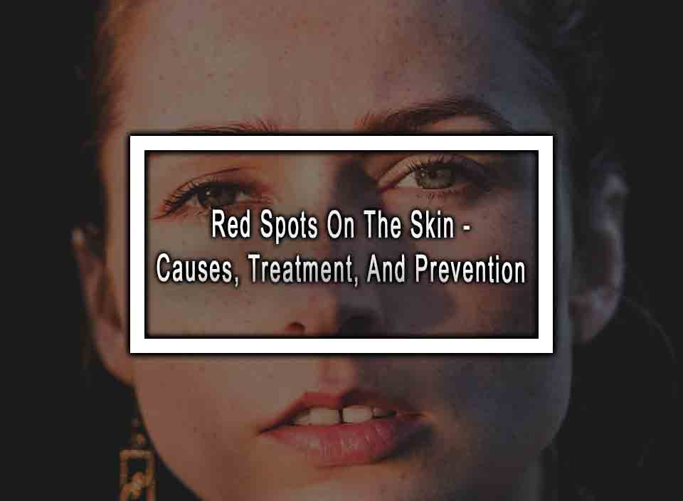 Red Spots On The Skin - Causes, Treatment, and Prevention