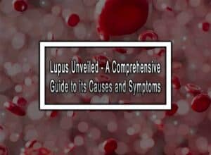 Lupus Unveiled - A Comprehensive Guide to its Causes and Symptoms